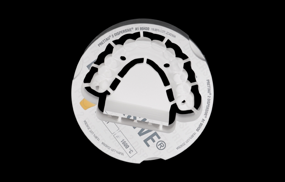 Obr. 4: Sekundární zirkoniová konstrukce je pevně fixována na primární strukturu ICE Plus, čímž vzniká plně keramická hybridní náhrada bez kovových komponent.