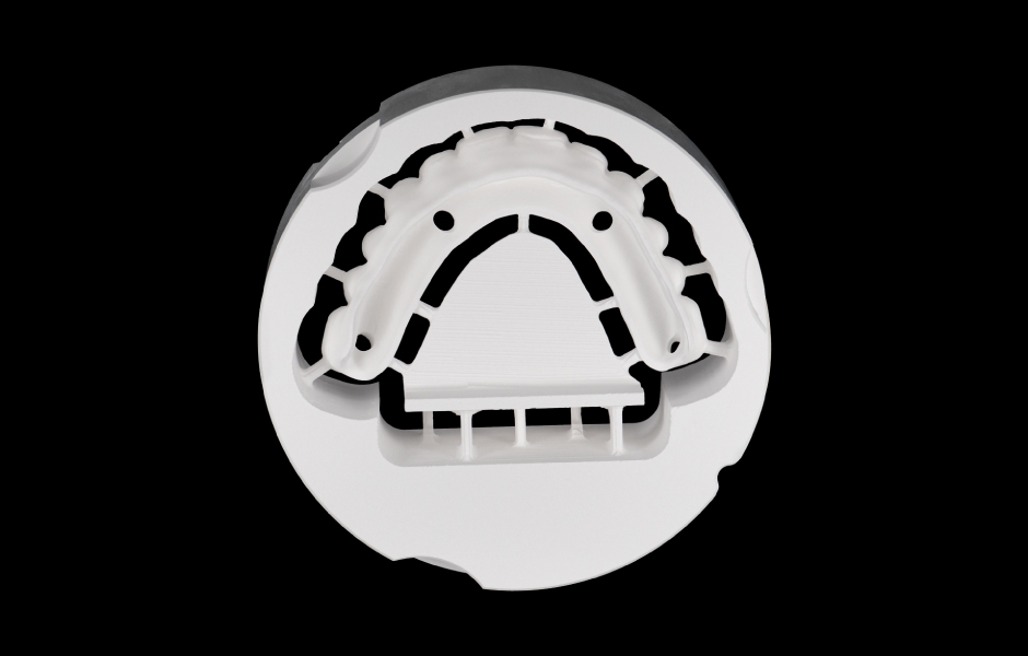 Obr.5: Sekundární zirkoniová konstrukce je pevně fixována na primární strukturu ICE Plus, čímž vzniká plně keramická hybridní náhrada bez kovových komponent.