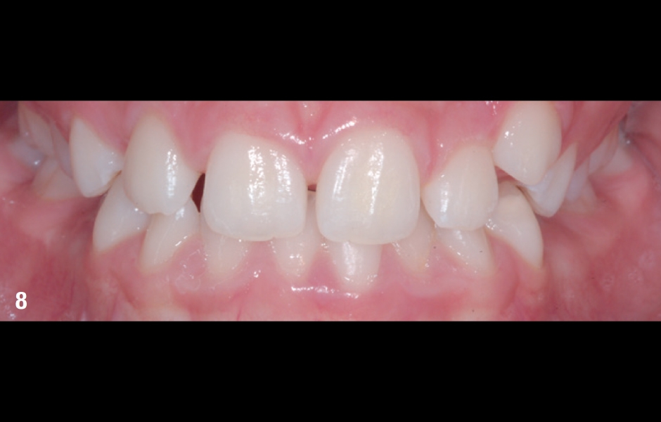 Obr. 8