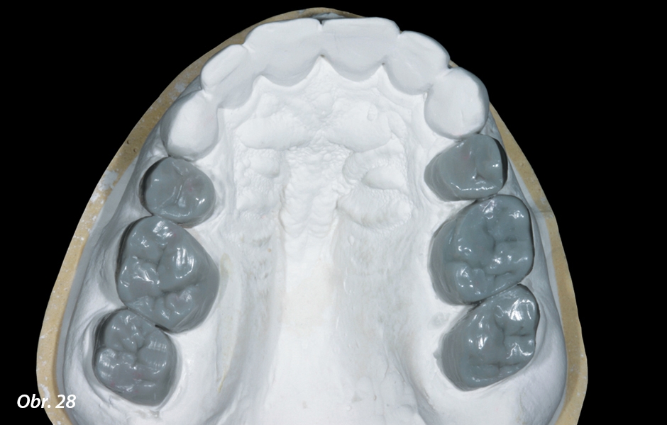 Okluzální pohled na diagnostický wax–up