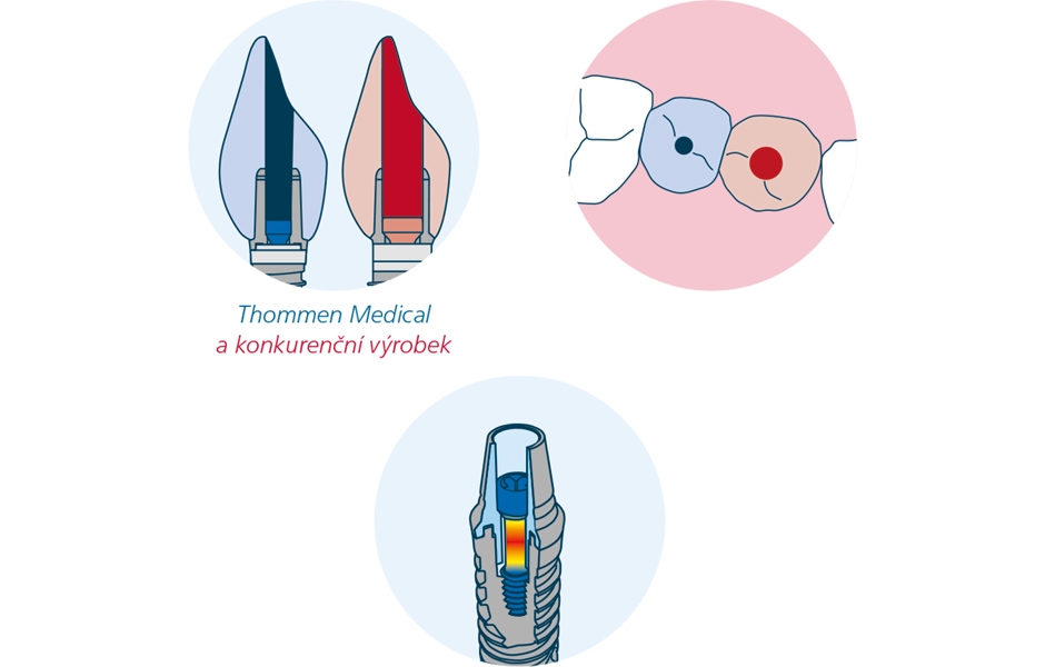 Thommen Medical a konkurenční výrobek