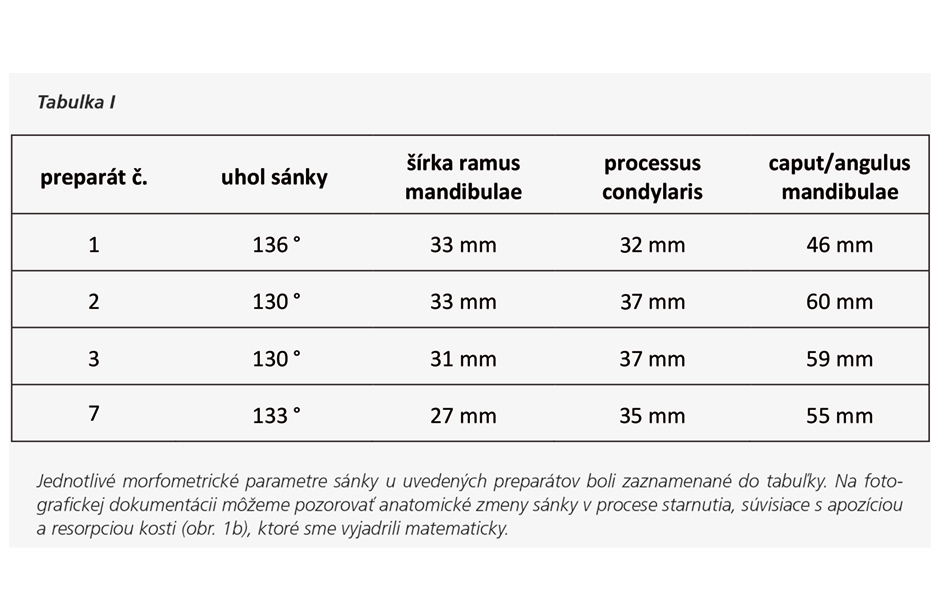 Anatomické zmeny temporomandibulárneho kĺbu v procese starnutia významné v klinickej praxi