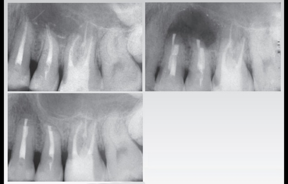  …a přináší bezpečné a prediktabilní výsledky v podobě úspěšného hojení