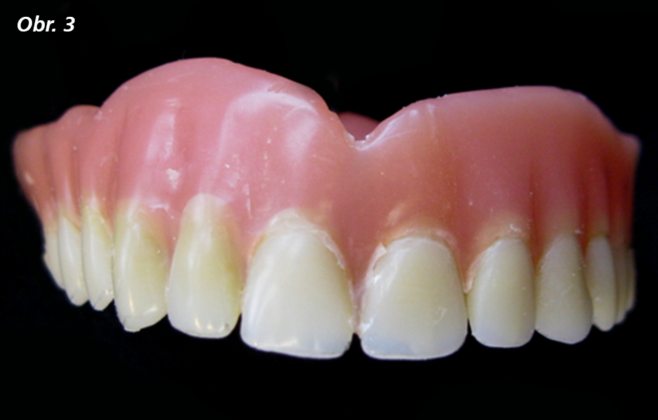 Stará zubní náhrada z klasické pryskyřice