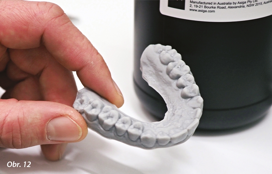 Hotový výrobek – ortodontický model připravený pro termoforming.
