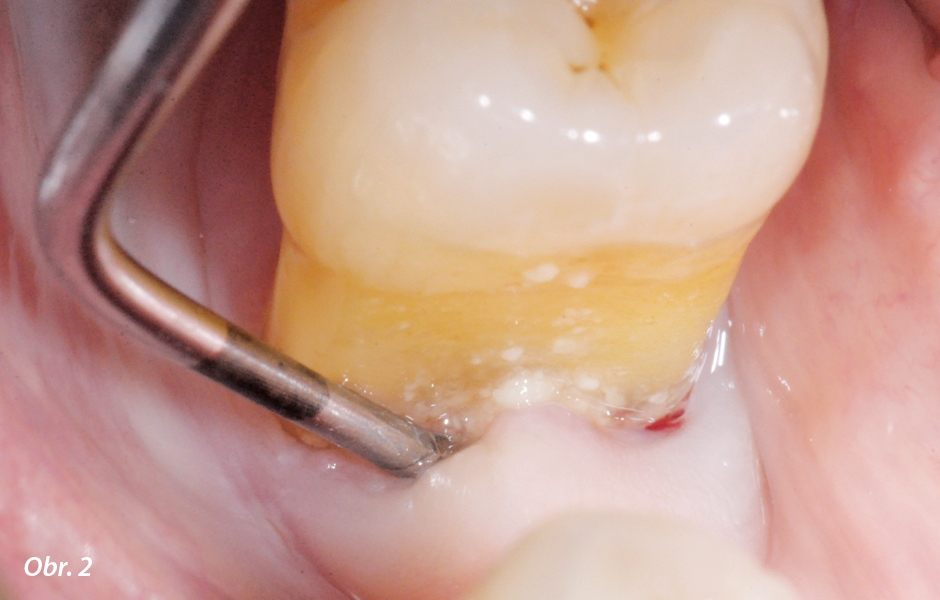  Dentální hygienistka v době SARS-CoV-2