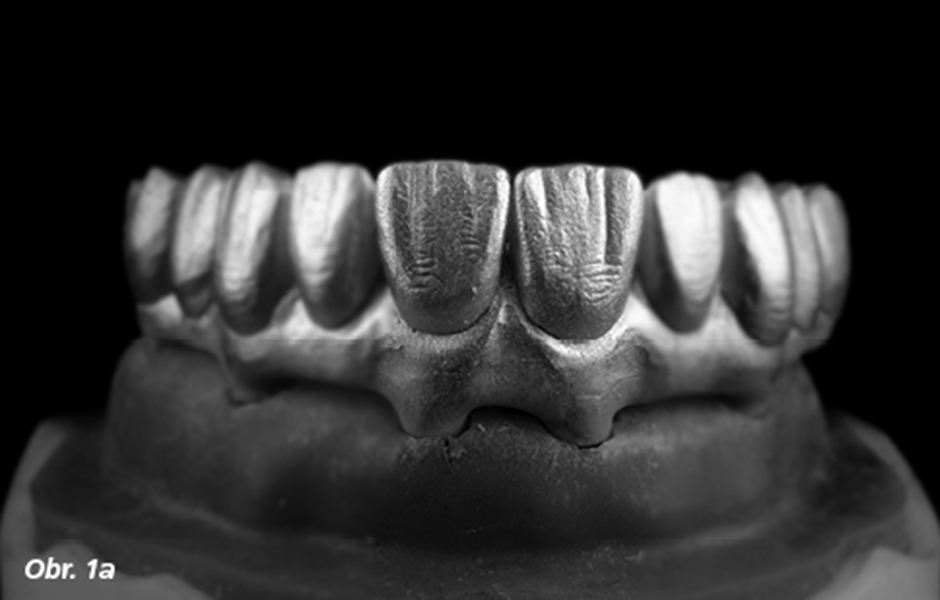 Digitální dentální fotografie – III. část