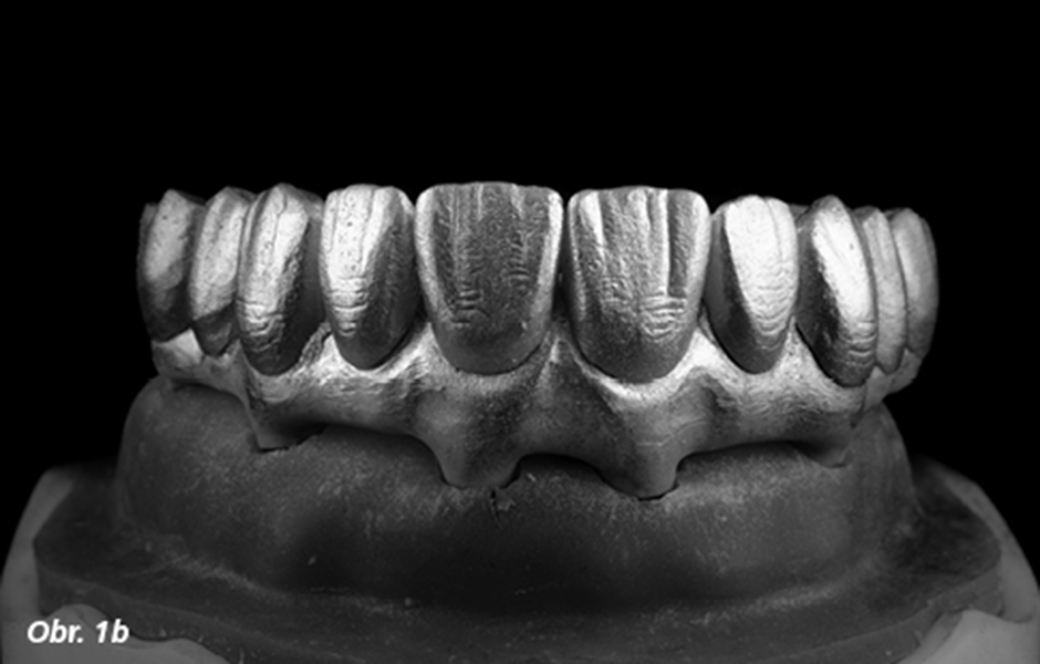 Digitální dentální fotografie – III. část