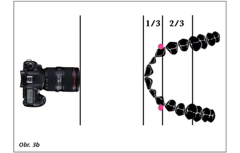 Digitální dentální fotografie – III. část