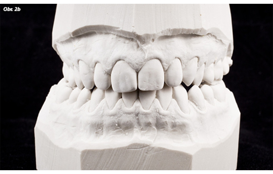 Digitální dentální fotografie – I. část