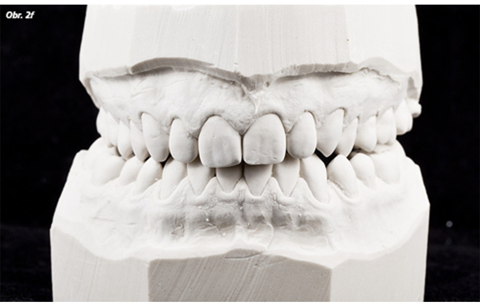 Digitální dentální fotografie – I. část