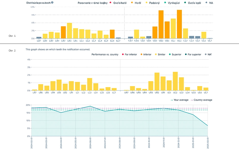 Obr. 1: Data DM Insights zobrazující problematické usazení alignerů na jednotlivých zubech v období od srpna 2023 do března 2024. Obr. 2: 1. graf: Míra problematického usazení alignerů na jednotlivých zubech v únoru 2025; 2. graf: Vývoj míry problematick