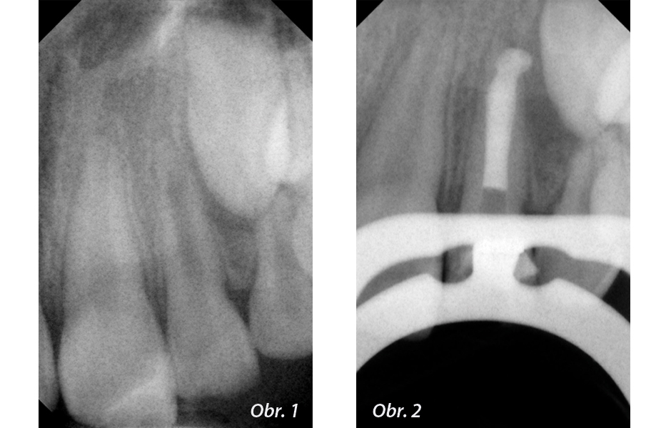 Obr. 1: květen 2008 / Obr. 2: červen 2008