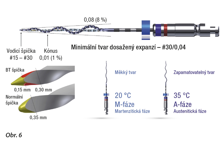 Zde je ukázán přehled jedinečných funkcí XP-endo Shaperu. Diskontinuální adaptivní pohyby pro debridement přesně napodobují Schilderovu plochu pohybu.