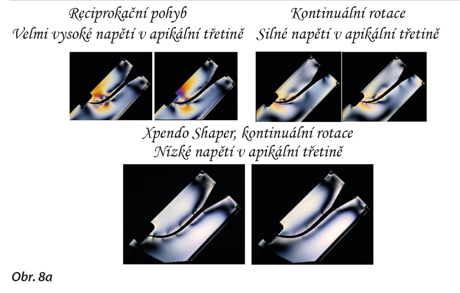 Fotoelasticita je experimentální technika pro analýzu napětí a deformace používaná pro podmínky s komplikovanou geometrií nebo zatížením. Jak dokládají doprovodné obrázky, XP-endo Shaper vykazuje nejméně napětí v apikální třetině.