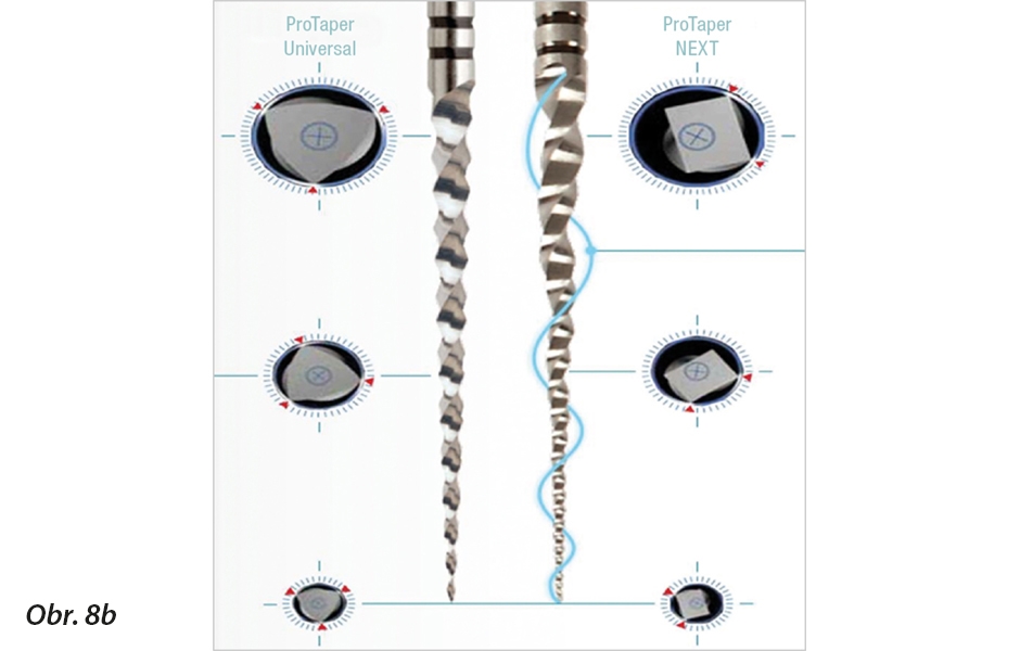 ProTaper NEXT byl prvním příkladem pokusu o únik od letmého dotyku s navrtáním a tažného pohybu většiny NiTi nástrojů. 