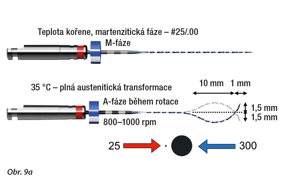 Apikálních 10 mm nástroje se v posledních několika milimetrech transformuje více koronálně na baňku a v posledních několika milimetrech na špičku. Při rotaci při teplotě kanálku vykazuje XP-endo Finisher celkové pohybové rozpětí 3 mm.