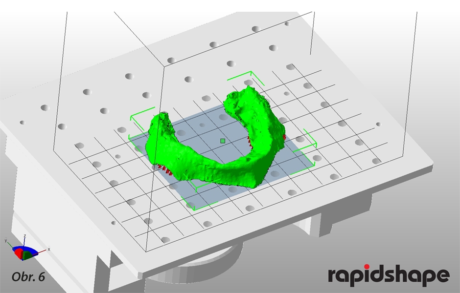 Úprava STL dat pro tisk modelu na 3D tiskárně