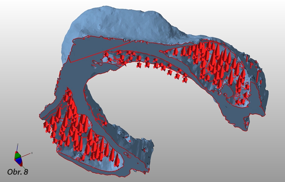 Úprava STL dat pro tisk modelu na 3D tiskárně