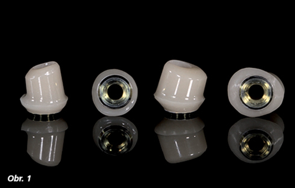 Náhrada obsahuje následující prvky: 4 teleskopické korunky (ICE Zirkon Transluzent) zhotovené na titanových abutmentech a kotvené k implantátům šroubkem 