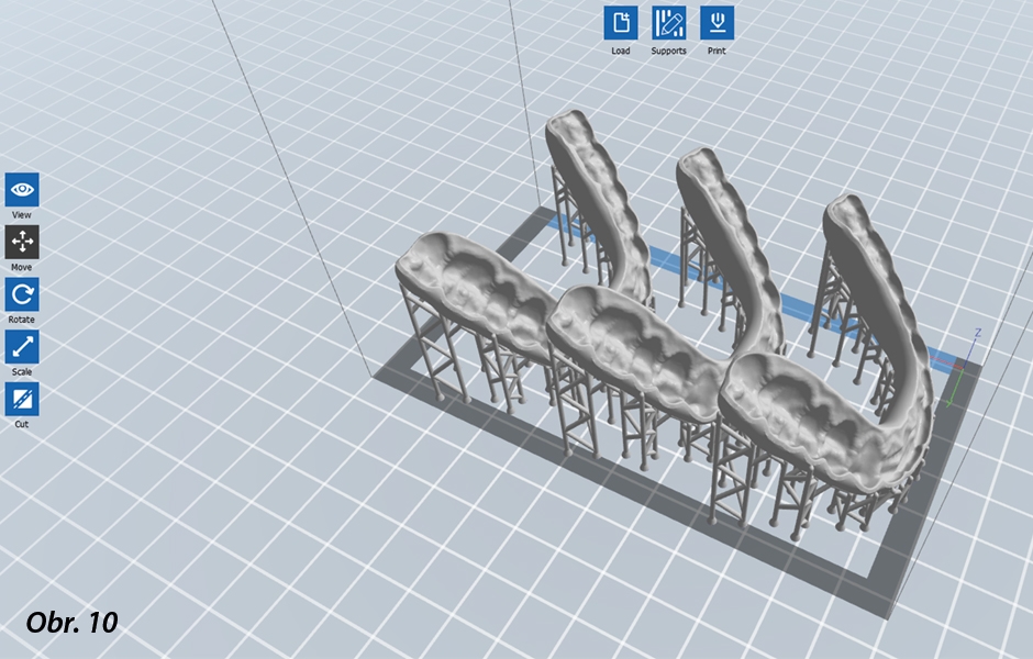 Rozložení okluzních dlah v softwaru pro 3D vrstvení