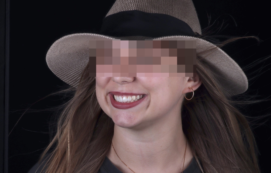 Obr. 15: Zářivý úsměv ve svatební den.