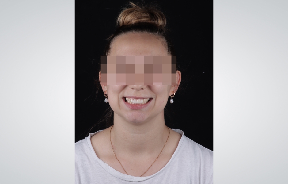 Obr. 7: Zkouška mock-upu.