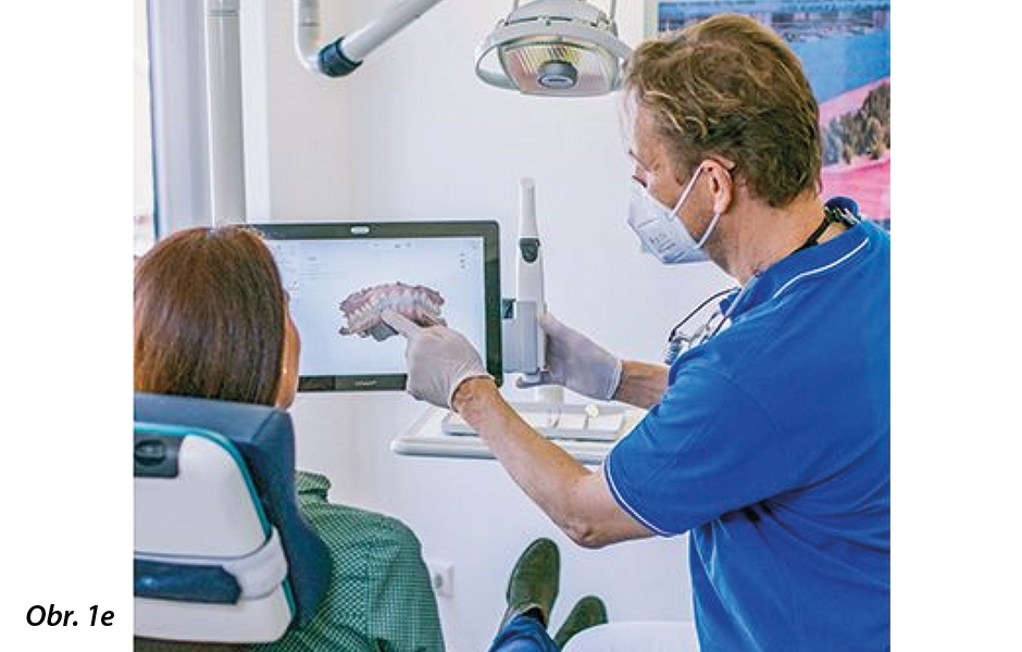 Pořídí se sken pro každého nového pacienta. Zaznamenává se situace v ústech a v reálném čase se zobrazuje na monitoru.