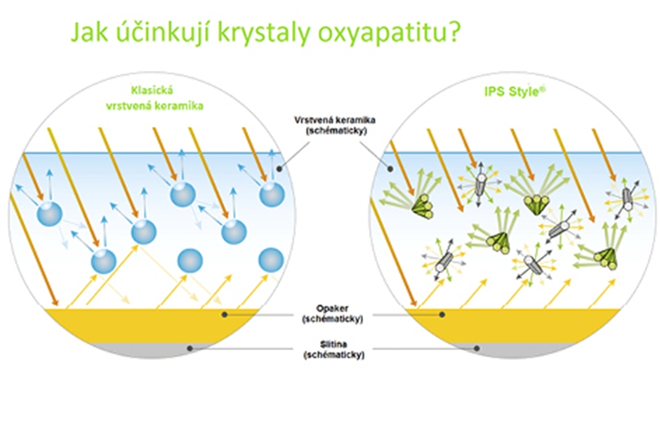 IPS Style®: Estetičtější, jednodušší, příjemnější – Ivoclar Vivadent představuje nový metalokeramický systém