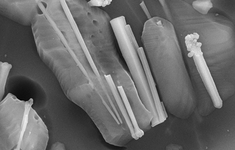 IPS Style®: Estetičtější, jednodušší, příjemnější – Ivoclar Vivadent představuje nový metalokeramický systém