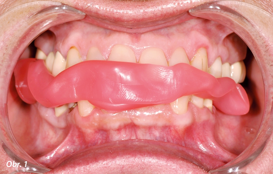 Zubní lékař nemá žádnou kontrolu nad polohou čelistí