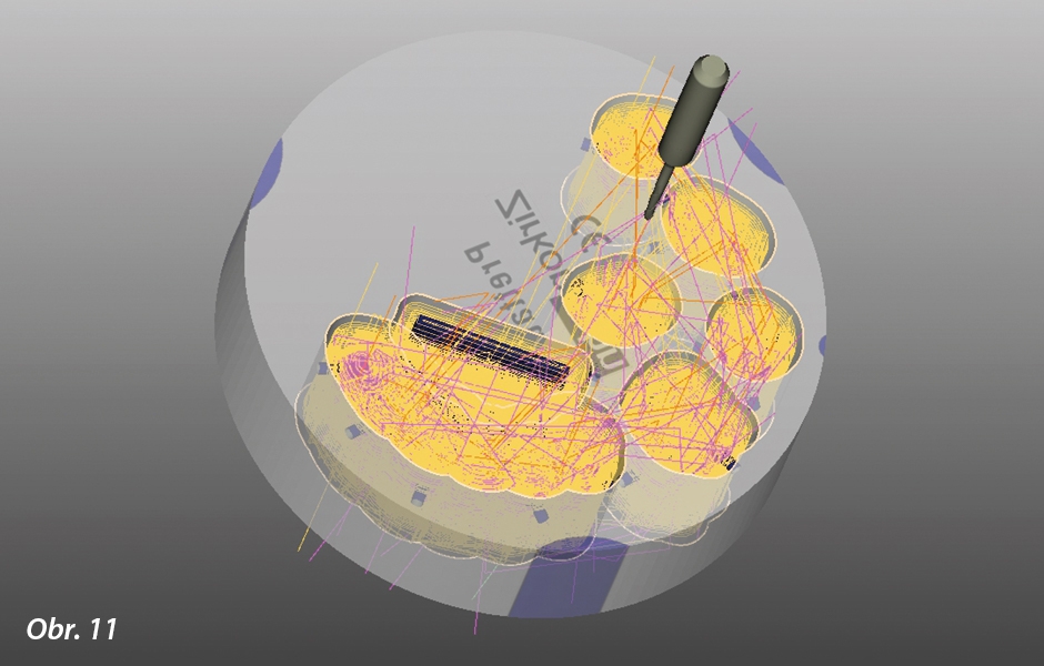 Kombinace zubů a implantátů – plně anatomické náhrady z PRETTAU® 2 ZIRCONIA