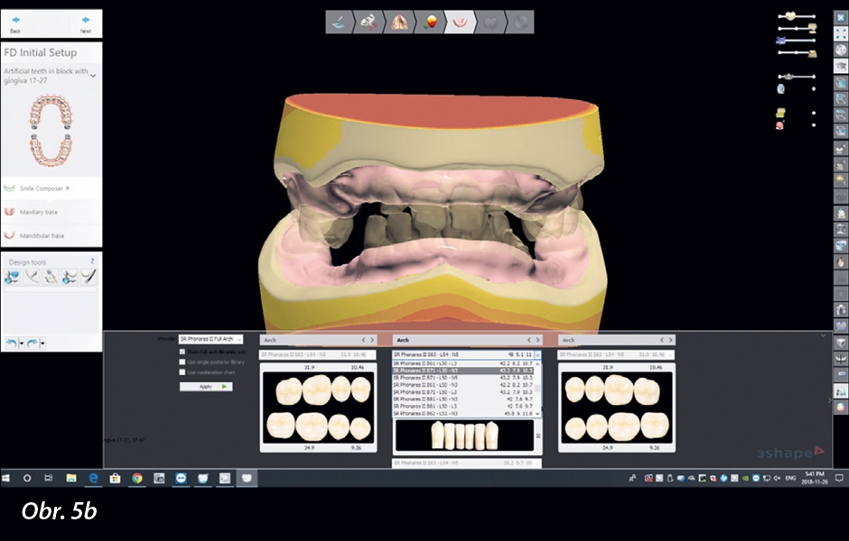 Otevření vertikálního rozměru o 5,5 mm a volba tvaru zubů v knihovně Digital Denture Full Arch