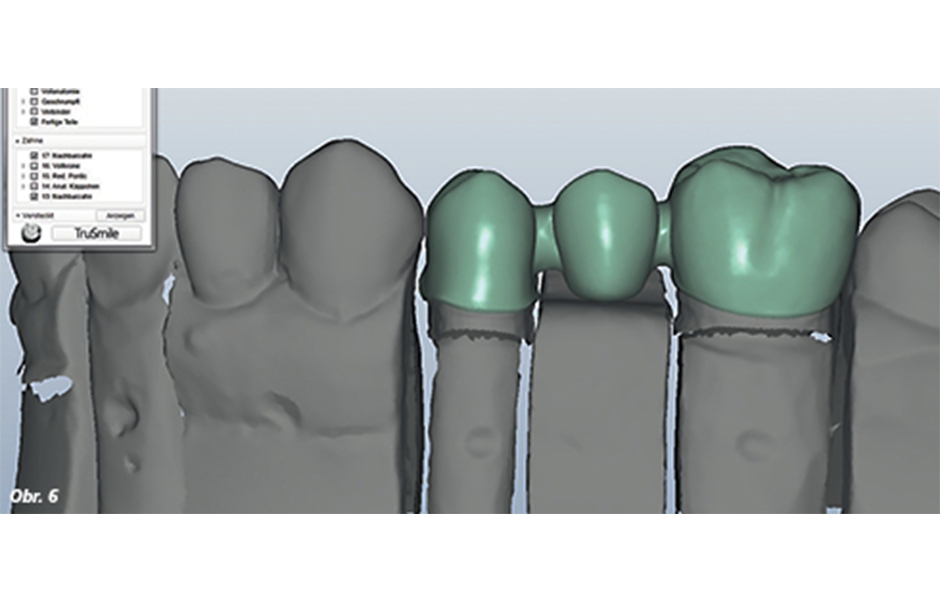 Návrh konstrukce sekundárního dílu v CAD software