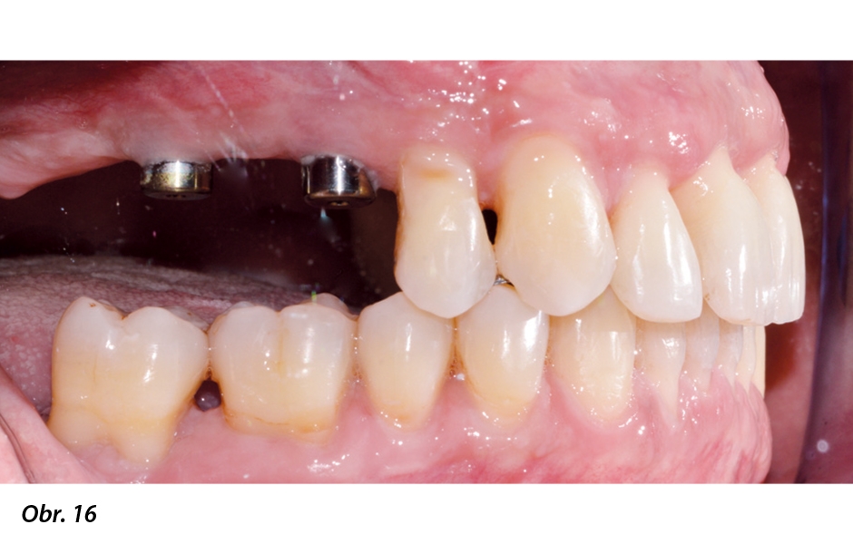 Závěrečné záznamy ortodontické léčby