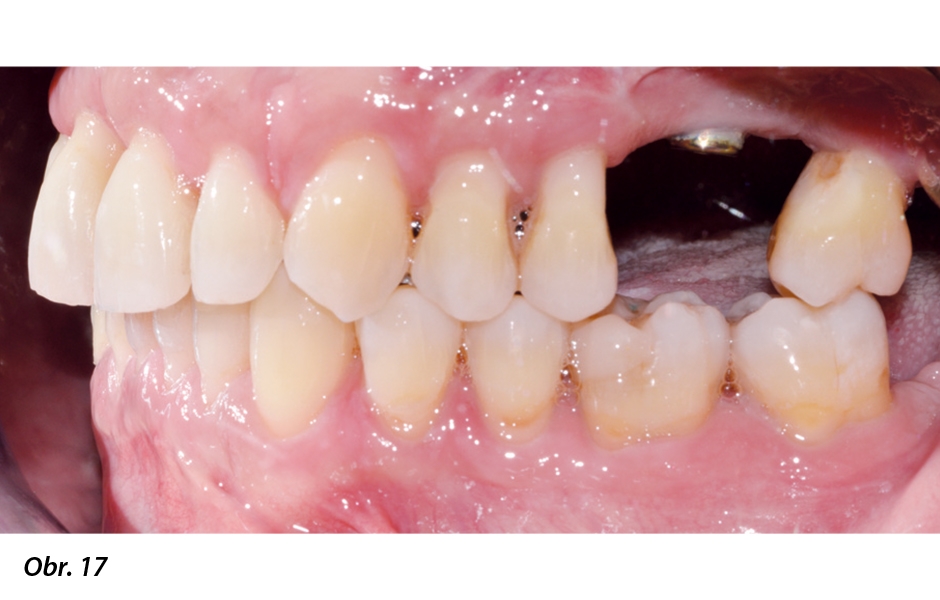 Závěrečné záznamy ortodontické léčby