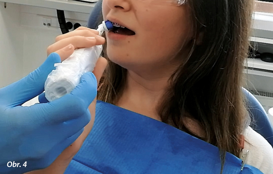 Inštruktáž pacienta s elektrickou zubnou kefkou (vlastný archív autorov)