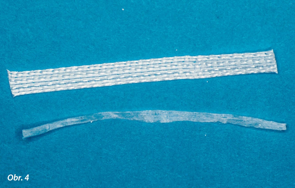 3 mm široký pásek Ribbond THM byl odstřižen ve stejné délce jako šablona ze zubní nitě