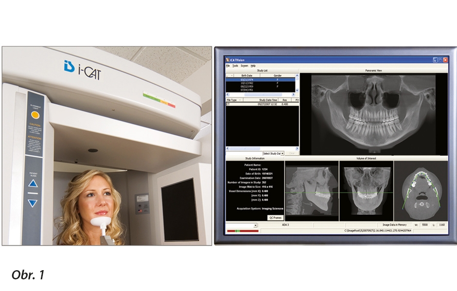 CBCT poskytuje rychlé skenování a okamžitou rekonstrukci (obrázek publikován se svolením i-CAT)