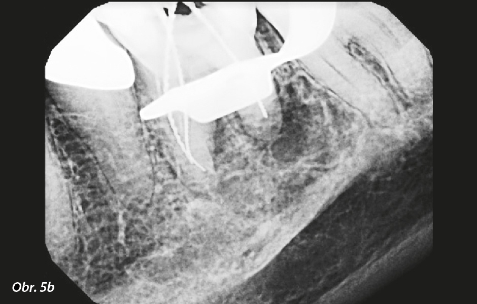 Snímky od předchozího endodontisty