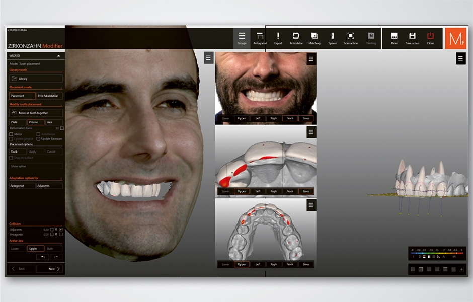 Nový software Zirkonzahn.Modifier s koncepcí virtuálního stavění zubů a s četnými vylepšeními