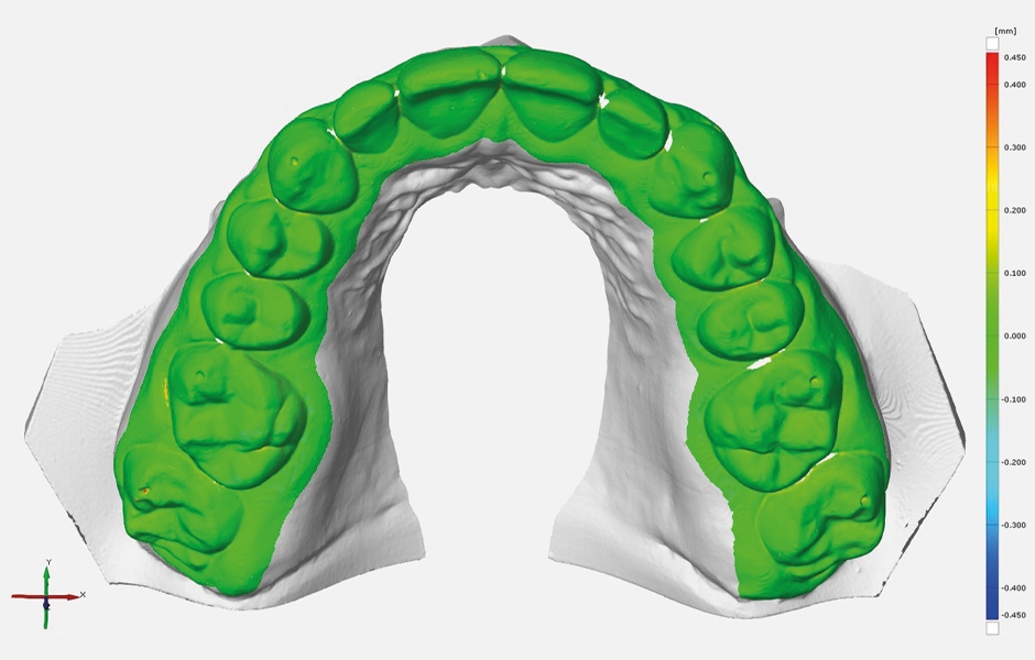 Představení Form 3BL, velkoformátové dentální 3D tiskárny pro velkoobjemovou dentální výrobu