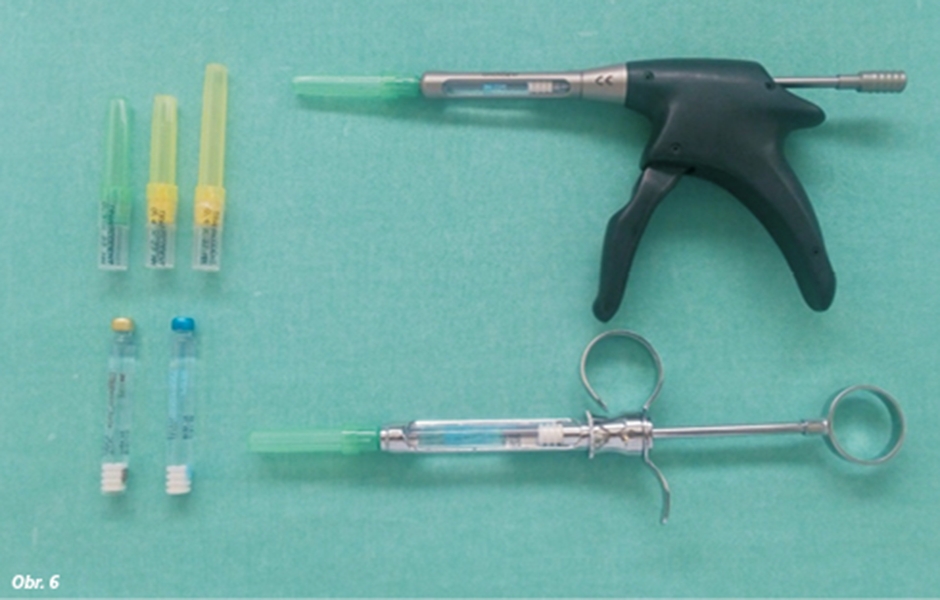 Inštrumentárium k podávaniu intraligamentárnej anestézie