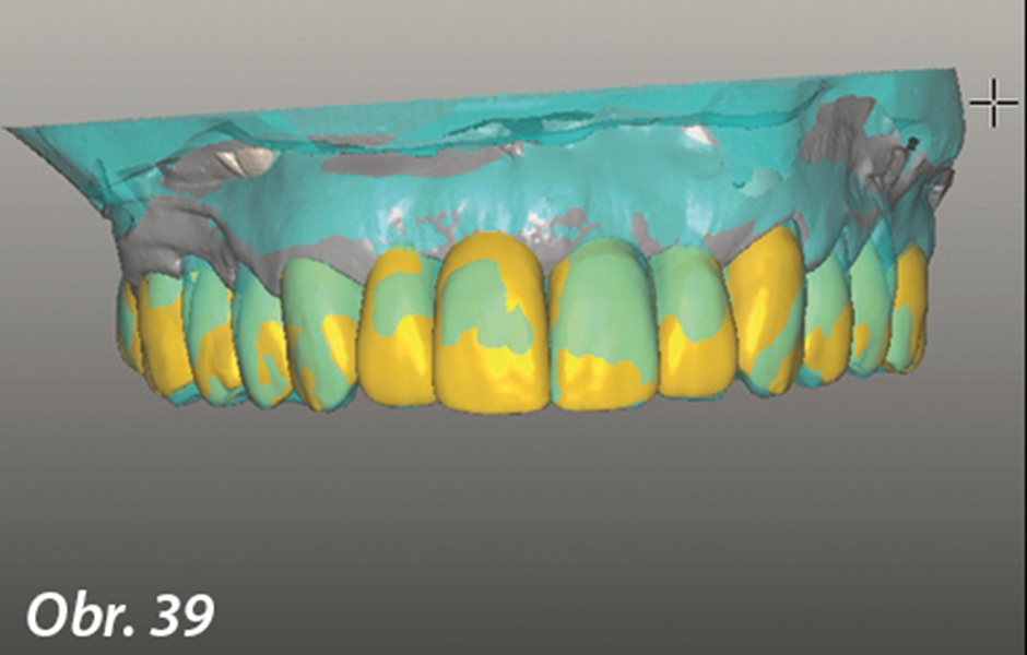 Protetický design, estetika, 3D gnatologie – 2. část