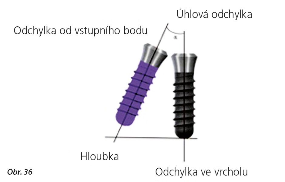 Rehabilitace částečné bezzubosti prostřednictvím počítačem navigované chirurgie: systematické ověřování