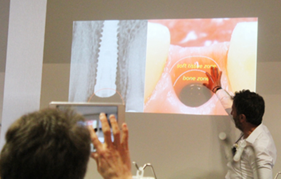 Reportáž: Workshopy periapikální mikrochirurgie a laterální sinus lift