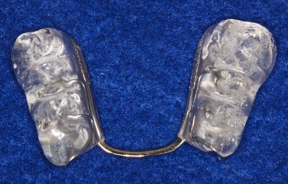 Obr. 7: Dolní repoziční dlaha překrývá premoláry a první moláry.