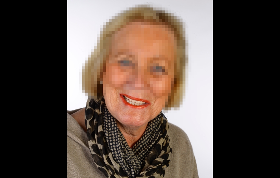 Obr. 23: Pacientka již velmi spokojená s „průběžným výsledkem“.