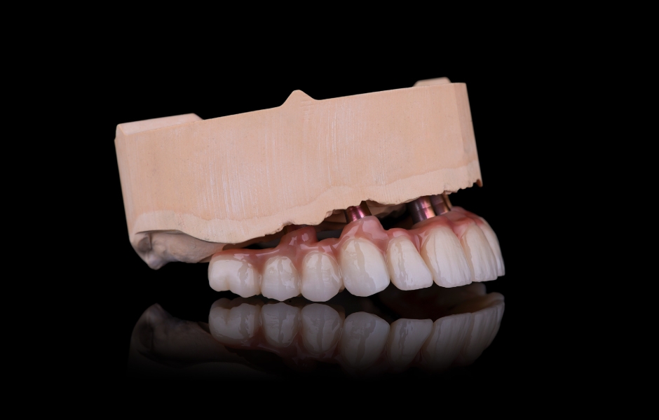 Obr. 24: Laterální pohled zleva a zprava na definitivní rekonstrukci.