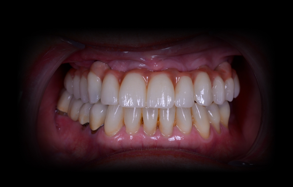 Obr. 29: Harmonicky sladěné zubní oblouky.